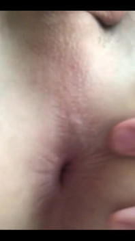 My hole today