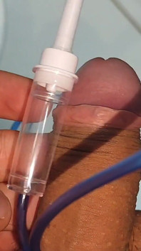 Extreme Insertion Into the Glans of the Pointed Straw.