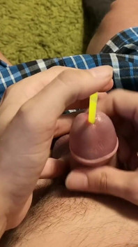 Urethra Sounding 2