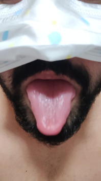 Dickontop
