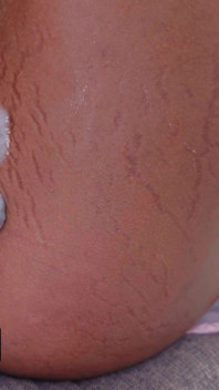 The Sneaky Link Always Comes Correct