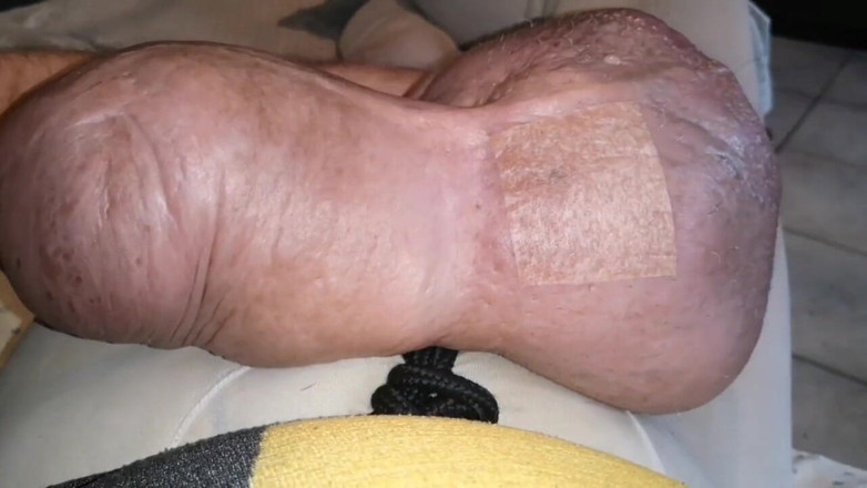 Monster_Meat_: 실리콘으로 가득 찬 고기가 부은 음란한
