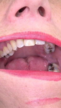 Mouth fetish clip with ali bordeaux fullhd - Inside my mouth