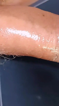 Collezione di urine - doccia dorata