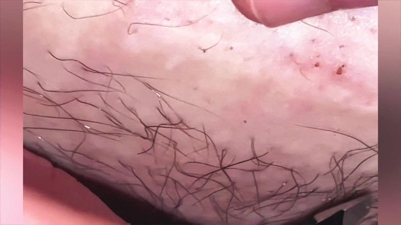 SatisfyingDillyDally: Me arrancando