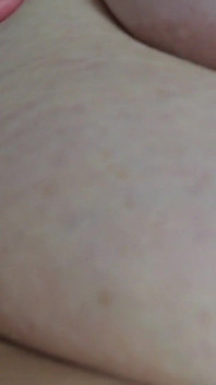 SSBBW up Close Body Exploration Stretch Marks