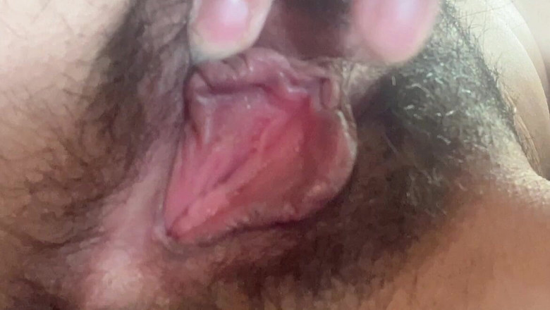 sweethanajapanese: Sclose up Tiny Asshole Hairy Pussy Lip