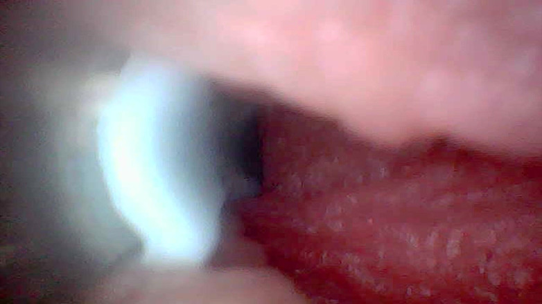 Twittiy: Vamos dar uma olhada na minha buceta suculenta juntos (câmera de...