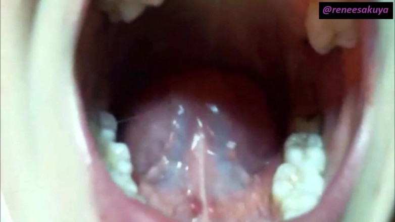 Renee Sakuya: Bao bên trong miệng tôi