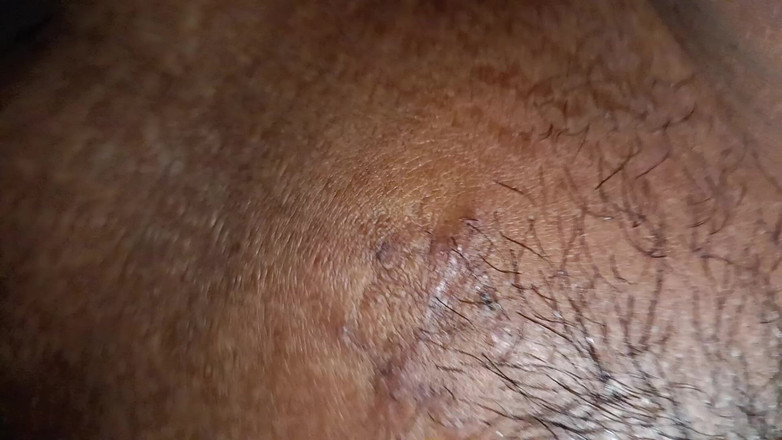 WoolyOption5: La Cognata Del Vicino È Stata Dimenticata Di Notte E Da...