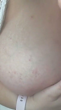 Masaje De Pecho Con