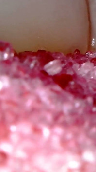 Medical Endoscope Oral Exam: Gummy Chewing, Extreme Teeth & Tongue Macro