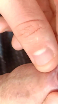Tight Foreskin Large Cock Play- Playing with My Uncut Foreskin Phimosis Cock