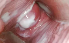 Endoscopio nella mia figa