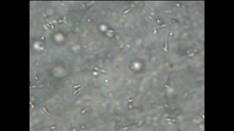 Mark Hannes: Sexdoll, creampie, masturbation avec du sperme sous la loupe