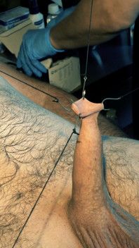 An Artful Study in Needles and Steel