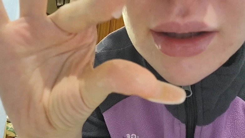 LDBMistress: Snot všude
