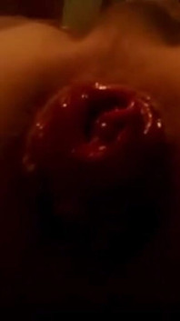 私が初めて撮影した肛門脱の動画
