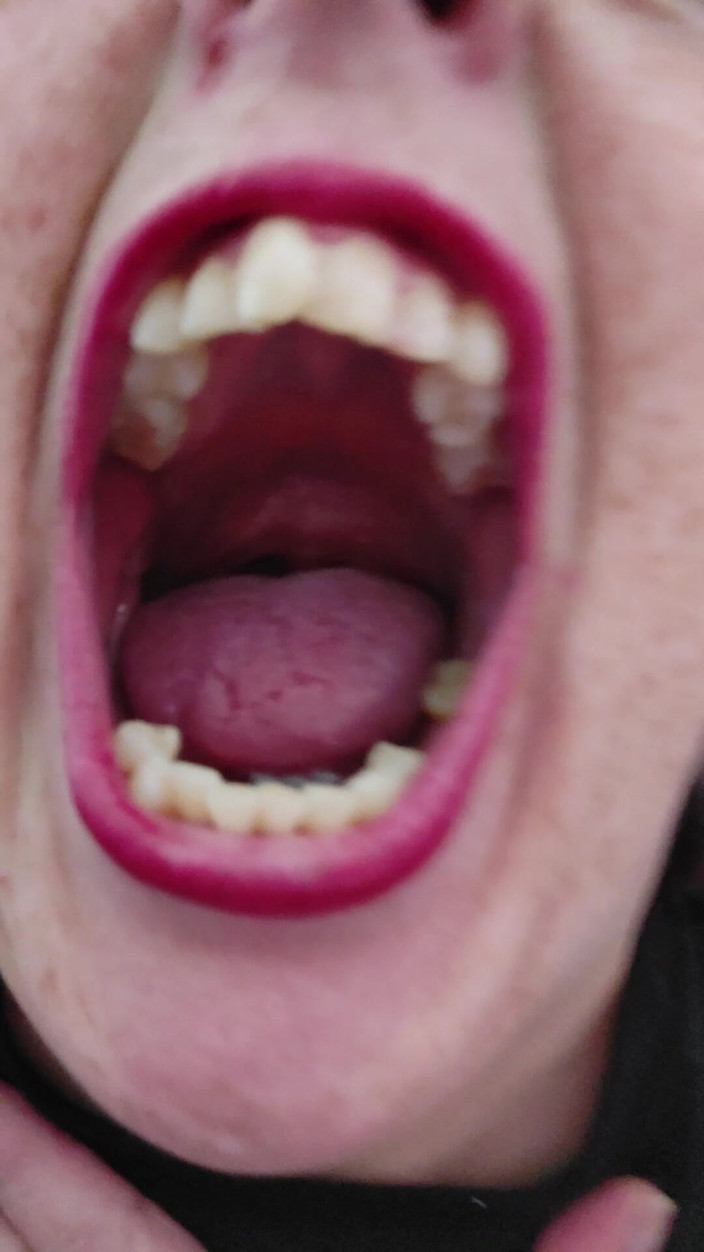 AngYourDirtyCanadian: Close up of My Mouth and Tongue