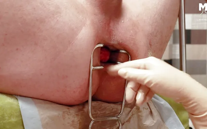 Marcus Pollack: Speculum stretching for subs hole