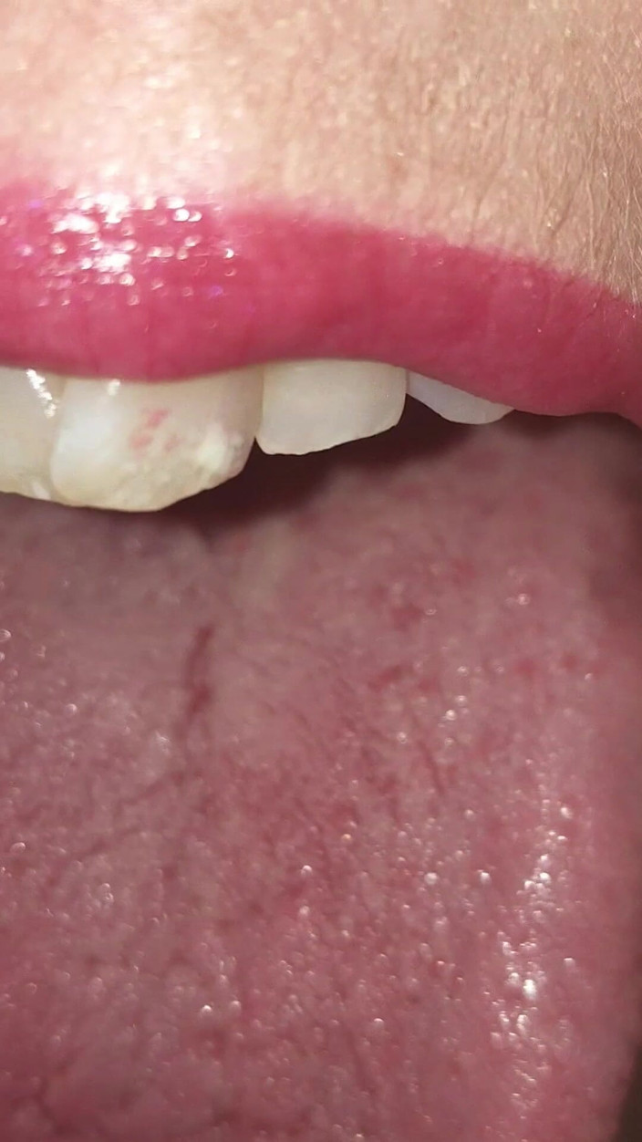 AngYourDirtyCanadian: Uvula plagen: extreme orale close-up