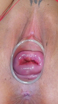 Ik neuk mijn baarmoederhals met een blauwe dildo met een bekken van 3,5 en 4,5 cm.