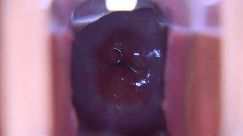 Asian happy ending: Asian Angel 19115