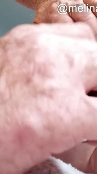 Anal Polishing