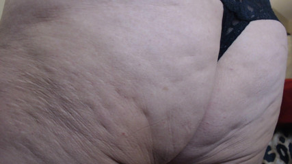 Abby Anna: Cellulite ass