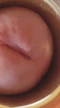 Boy Close up Tight Uncircumcised Glans Excited