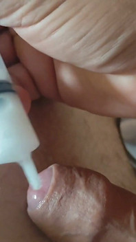 Reuse of Cum Through the Urethral Canal.