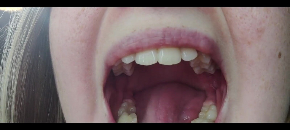 RavenHearth666VIP: Hrdlo fetiš