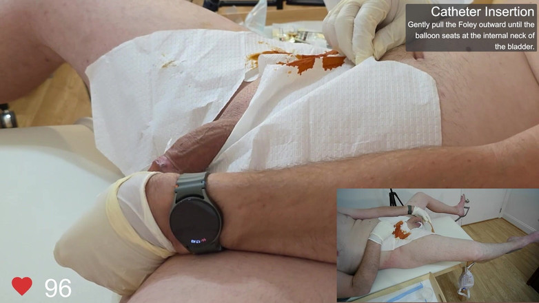 Clinical Climax: 카테터 삽입