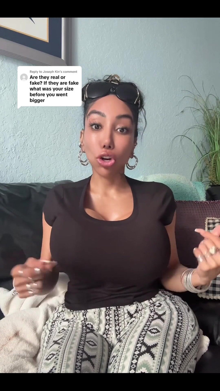 Anakaliyah: Jen se chci podělit o některé z mých plastických operací