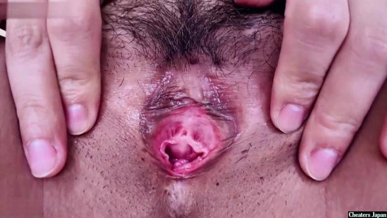 Asian happy ending: Hennes organ för återbetalning av lån