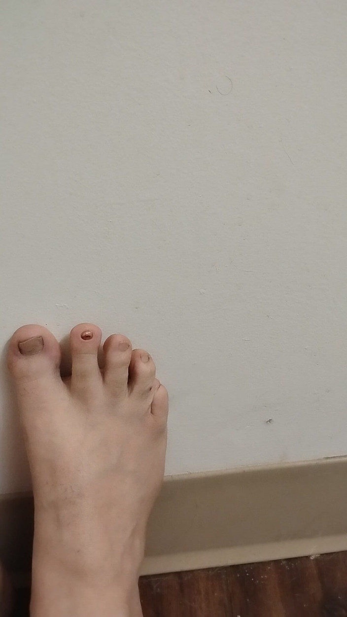 JG Risk: 11-26-2025 Roztomilé malé prsty