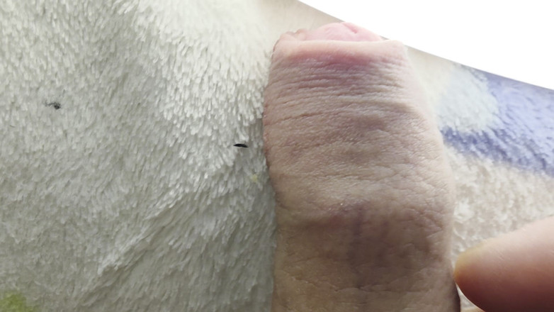 Nalekhome: マクロのチンコ