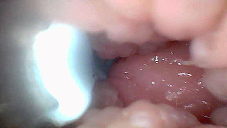Ladybottox: Panduan Visual untuk Perspektif Endoscop Stimulasi dan Orgasme G-spot