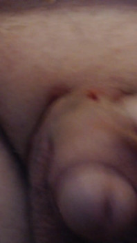 Zoppicare il cazzo