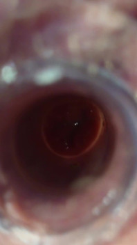 The Little Test with the Anal Tunnel