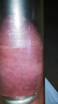 Es beginnt mit einem Finger ...