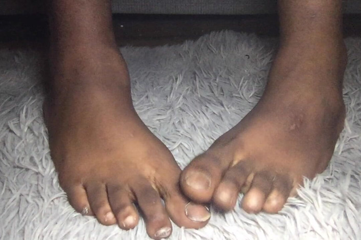 Teddy south: Big Black Feet