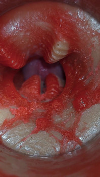 Camera Inside Deep Pussy Captures Very Huge Ejaculation of Sperm Asmr