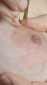 Plucking Hairs From the Breasts