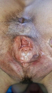 Close up on My Gaping Pussy and Ass