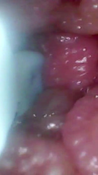 Endoscope Camera Records My Wife's G Spot. Educational Video Close up