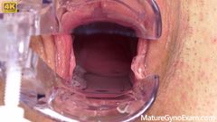 Mature Gyno Exam: Cervix of Shy MILF Revealed!