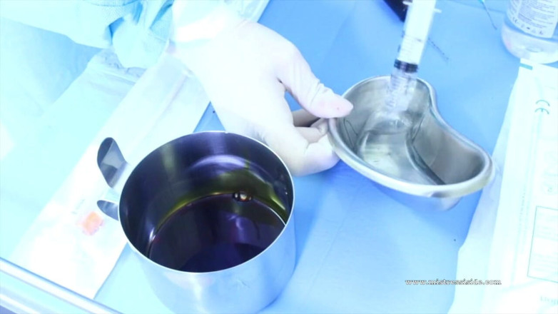 Mistress Iside: Amante vesical con catéter iside