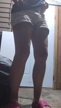 My Legs