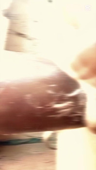 Adick of This Century It's Really Beautiful